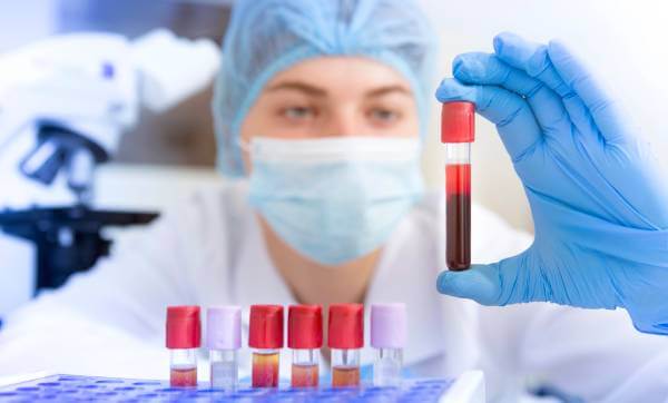 Nalazi krvi i tumor markeri raka pankreasa Rak pankreasa i krvna slika