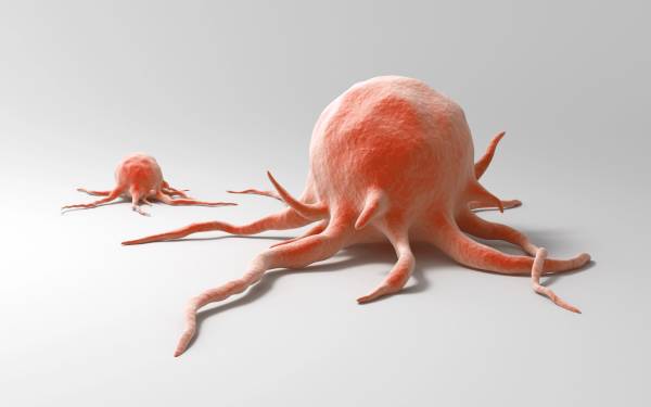 Najagresivniji tipovi raka Najsmrtonosniji rak