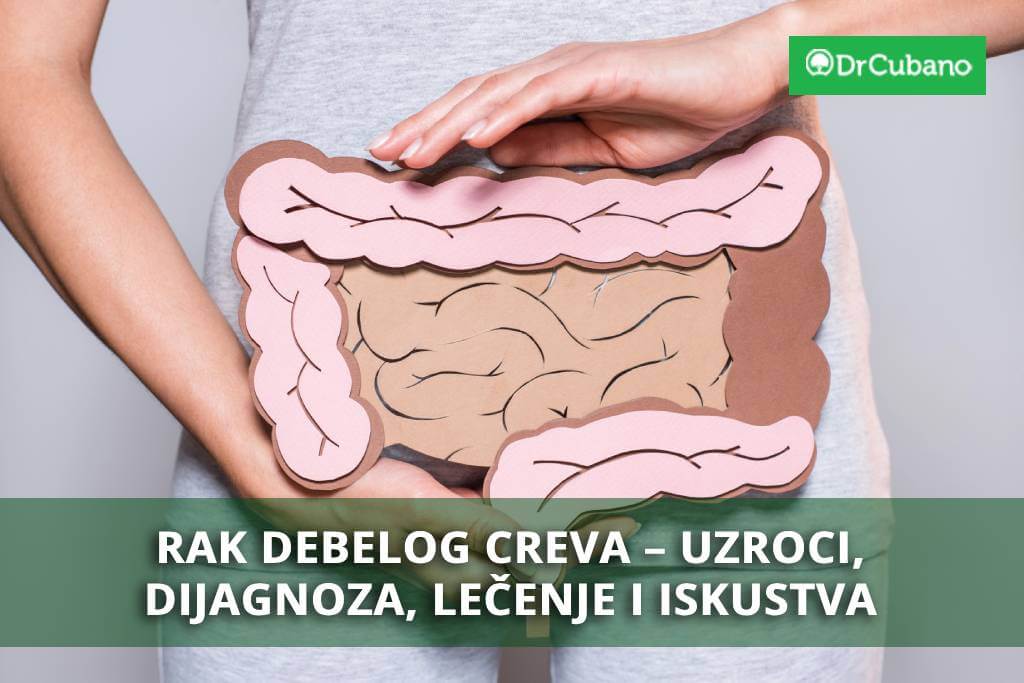 Rak debelog creva – Uzroci, dijagnoza, lečenje i iskustva