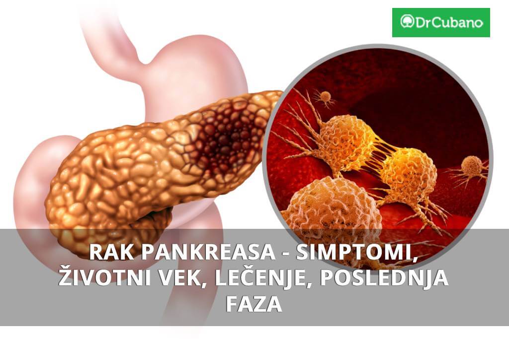 Kancer pankreasa