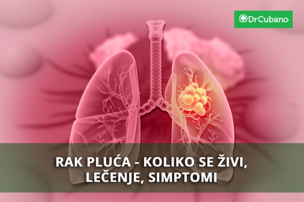 Definicija, lečenje i životni vek sa kancerom pluća