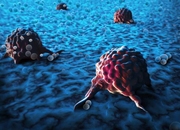 Definicija galopirajućeg rak Značenje galopirajućeg raka