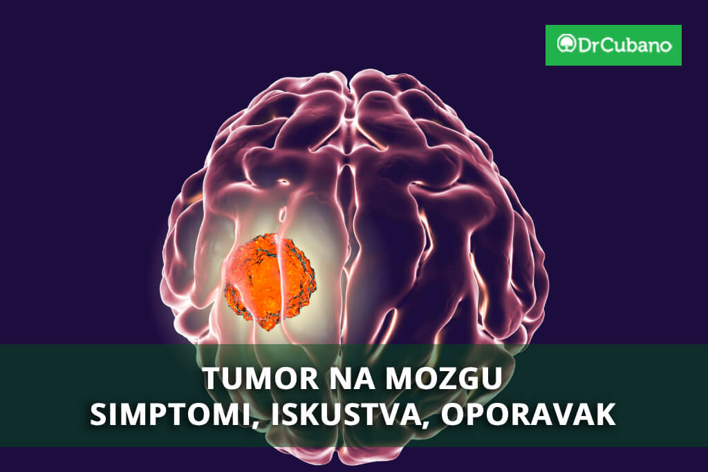 Tumor na mozgu: Simptomi, iskustva, oporavak, životni vek